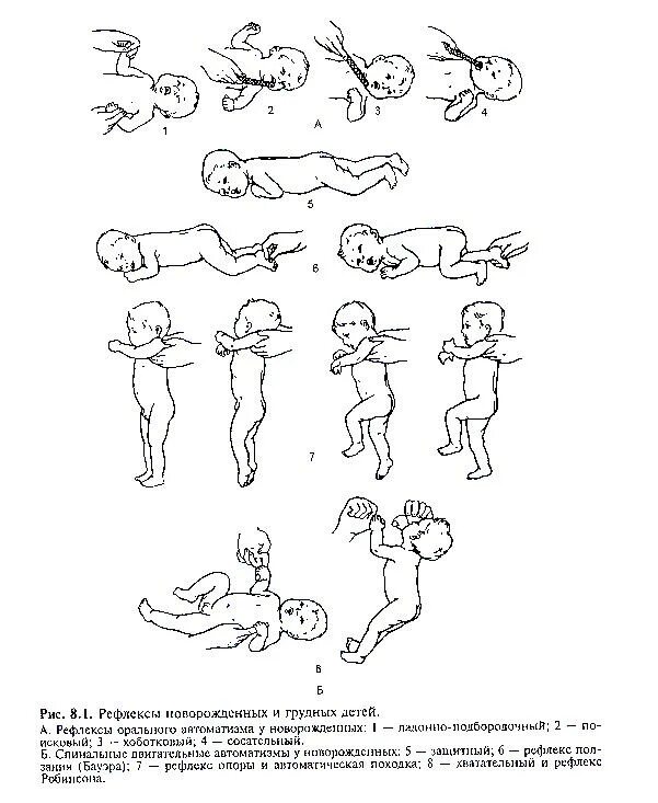 Спинальные двигательные рефлексы новорожденных. Рефлексы орального АВТОМАТИЗМА У новорожденных. Рефлексы новорожденного спинального АВТОМАТИЗМА. Спинальные сегментарные автоматизмы у новорожденных.