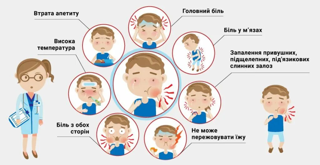 Какие признаки свинки. Эпидемический паротит Свинка симптомы. Эпид паротит у детей симптомы. Эпидемический паротит у детей симптомы.