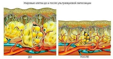 Клетки после