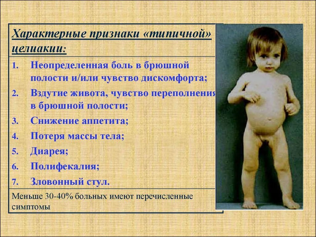 Синдром преждевременной
