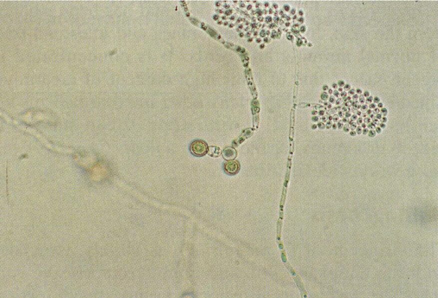 Споры гриба и нити. Бластоспоры кандида. Грибы Candida псевдомицелий. Грибы кандида микроскопия. Псевдомицелий микроскопия.
