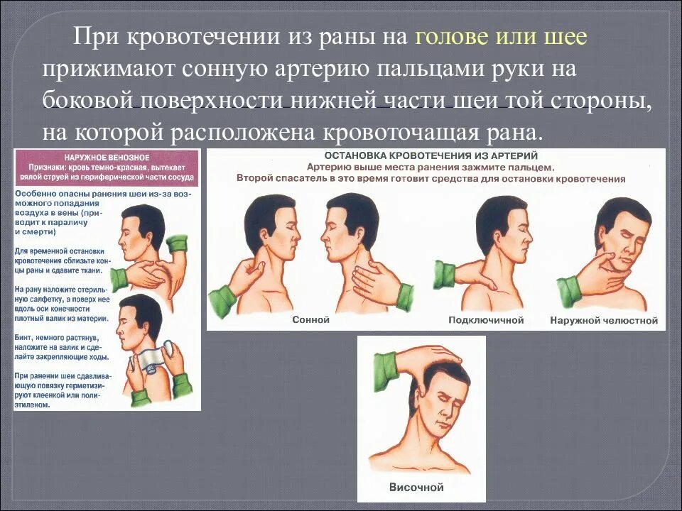 Остановить кровотечение на сонной артерии ответ тест. Способы остановки кровотечения из головы. Способы остановки кровотечения при ранении. Остановка кровотечения на голове. Способы остановки кровотечения головы.