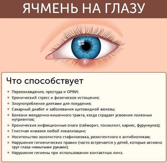 Ячмень на глазу: причины, симптомы, лечение, профилактика