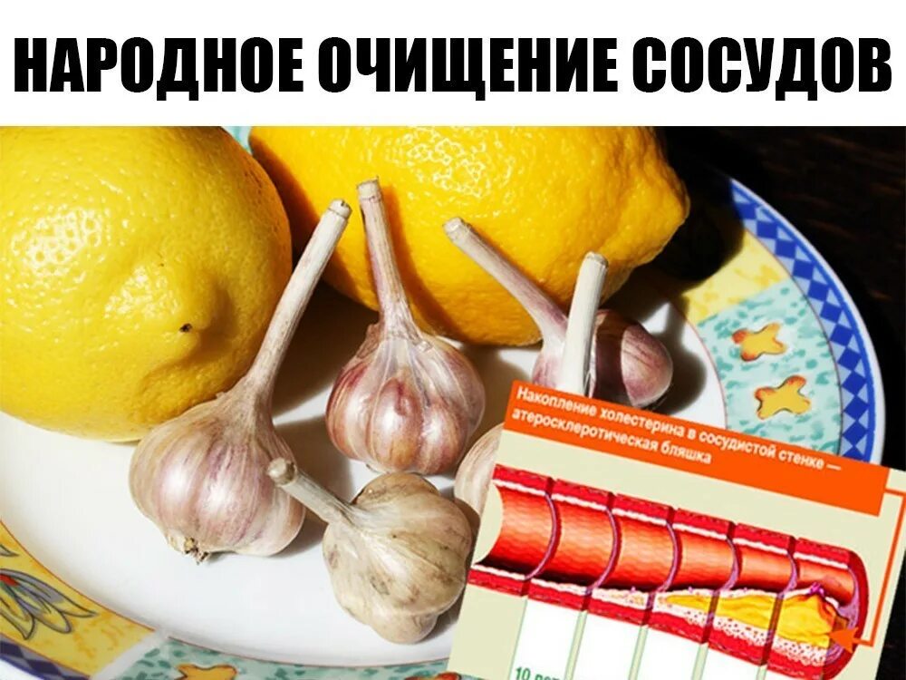 Чистка сосудов народными средствами. Народные средства для чистки кровеносных сосудов. Народный метод очистки сосудов. Народные методы чистки сосудов