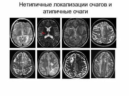 Единичные мелкие
