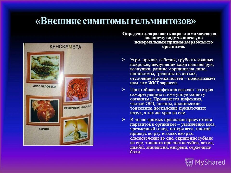 Как понять что в организме паразиты. Паразиты в организме человека симптомы. признаки глистов в органи. симптомы паразитов у человека.