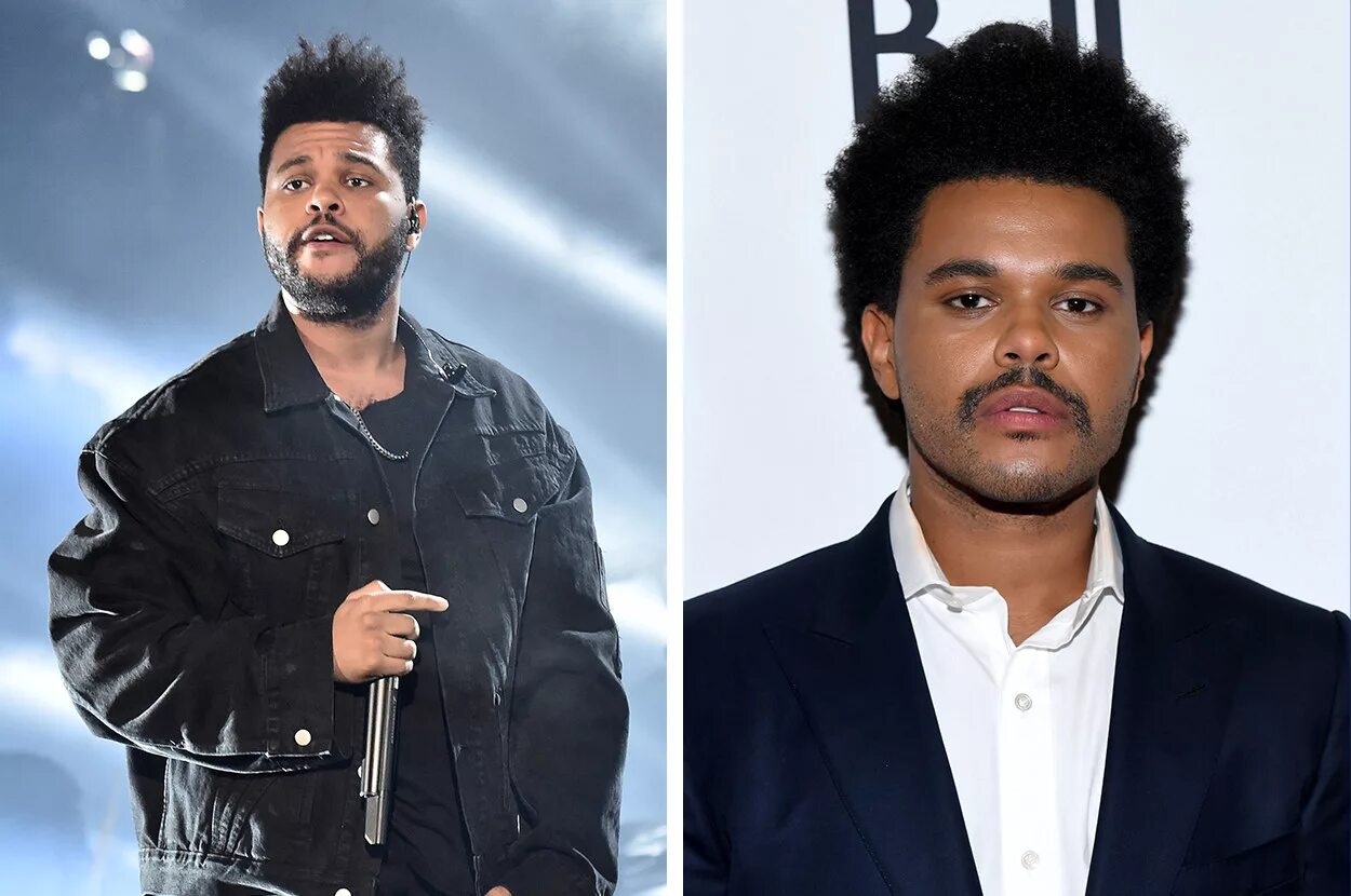 The Weeknd 2021 пластика. The Weeknd до пластики. The weekend сейчас. The Weeknd пластическая операция.