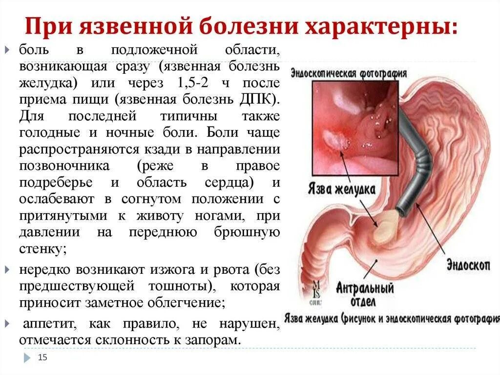 При кишечнике будет температура