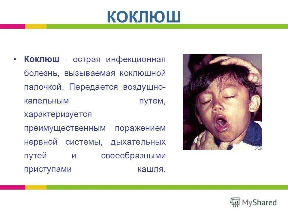 Коклюш бывает у взрослых и какие симптомы. Коклюш проявления болезни у детей. характерные клинические проявления коклюша. вызываемые заболевания коклюш. коклюш это инфекционное заболевание.