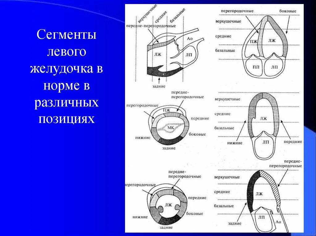 Локальная сократимость левого желудочка. Сегменты ЭХОКГ И стенки сердца. Сегменты лж на ЭХОКГ. Сегментарное строение миокарда ЭХОКГ. Сегменты миокарда эхокардиография.