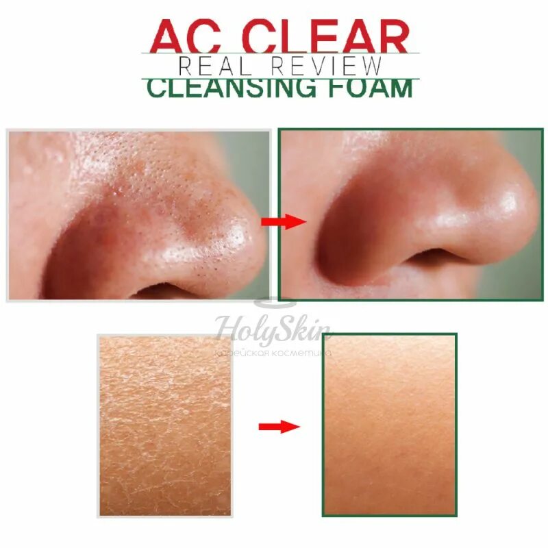 Ac clear. AC Clear Foam EYENLIP. Пенка для умывания EYENLIP AC Clear Cleansing Foam. Пенка для умывания для проблемной кожи EYENLIP AC Clear Cleansing Foam. EYENLIP пенка AC для умывания AC Clear Foam.