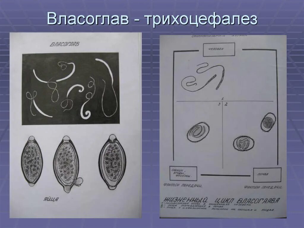 Власоглав Trichocephalus. Трихоцефалез – власоглав. Власоглав (Trichocephalus Trichiurus, прежнее название — Trichocephalus dispar). Власоглав Trichocephalus Trichiurus жизненный цикл.