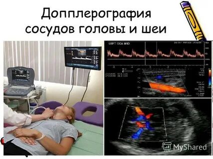 Доплер головного мозга