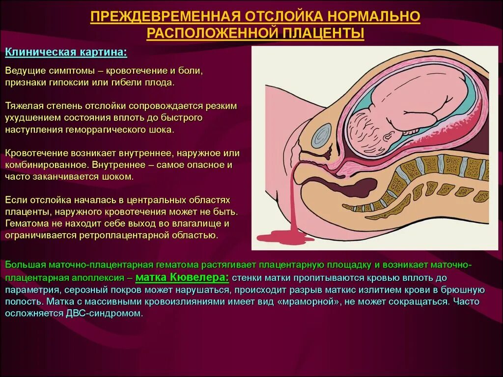 Секс Во Время Беременности Отзывы