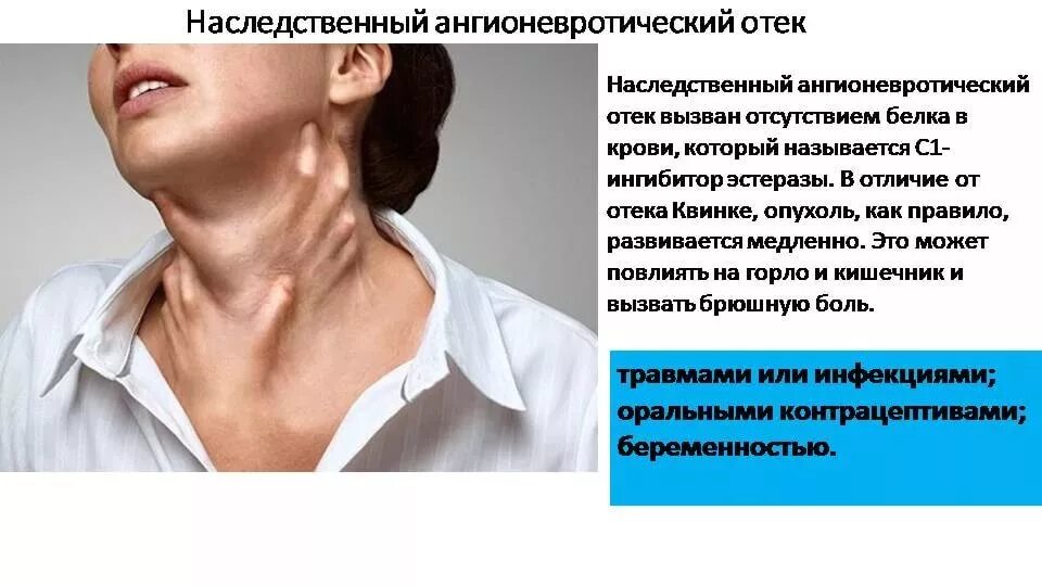 Почему оте. Ангоневратический атек. ангионевротический отек. наследственный ангионевротический отек. симптомы наследственного ангионевротического отека.