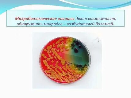 Микробиологическое исследование мочи