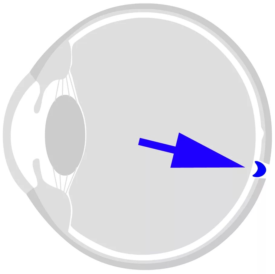 Зона глаз. Слепое пятно Мариотта. Слепые зоны глаза человека. Слепые зоны человеческого зрения. Слепое пятно человеческого глаза.