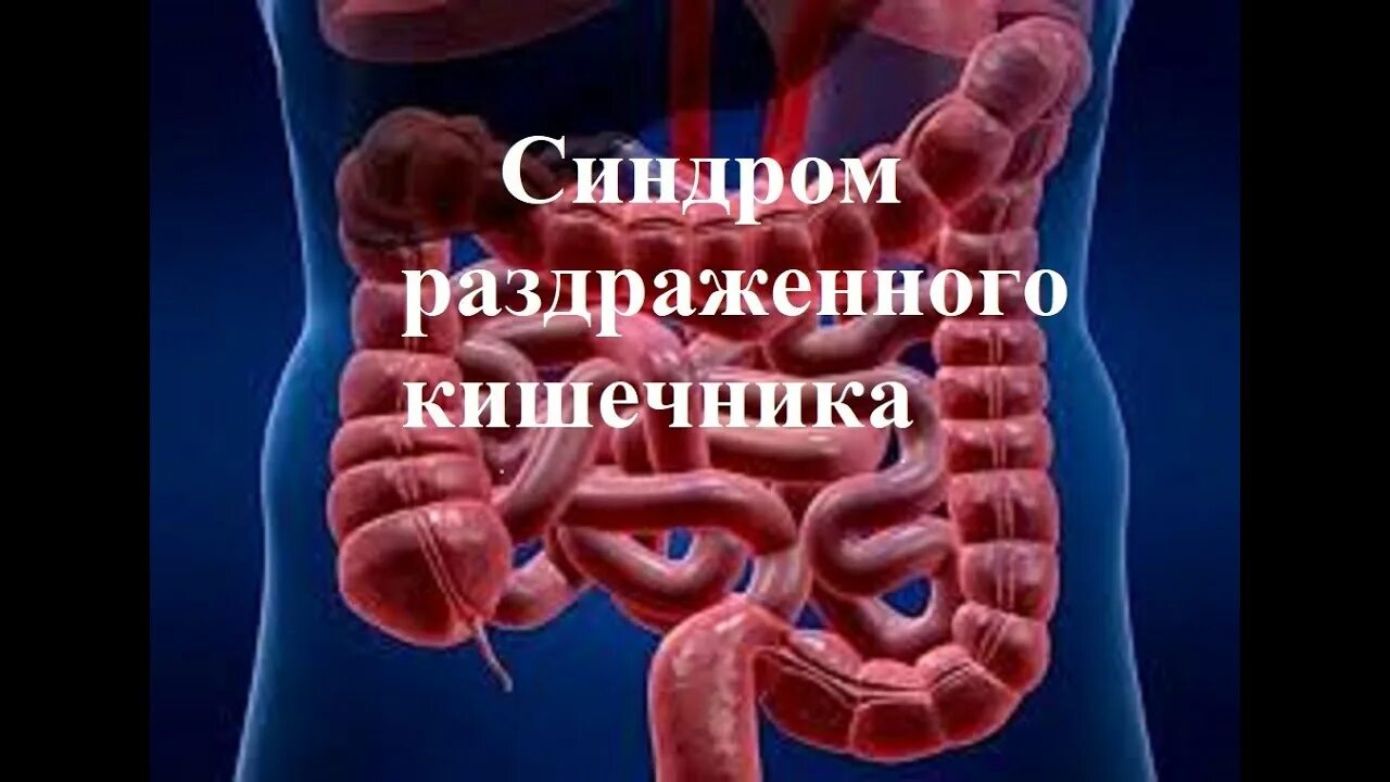 Синдром раздраженного кишечника. Синдром раздраженного кишечника (СРК). Синдром раздраженного кишечника симптомы. Раздраженный кишечник. Раздраженный кишечник симптомы и лечение у мужчин