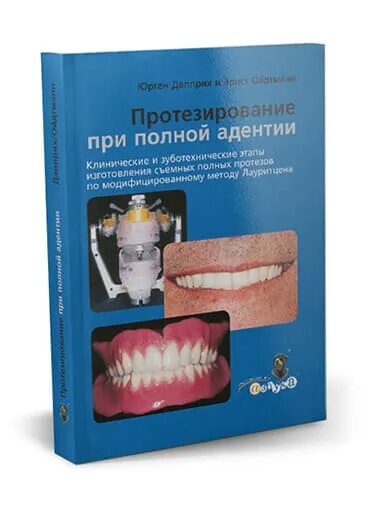 Несъемный протез на 4 имплантах. Юрген дапприх эрнст ойдтманн протезирование при полной адентии. Имплантация при полной адентии. Съемные протезы при полном отсутствии зубов. Протезирование зубов.