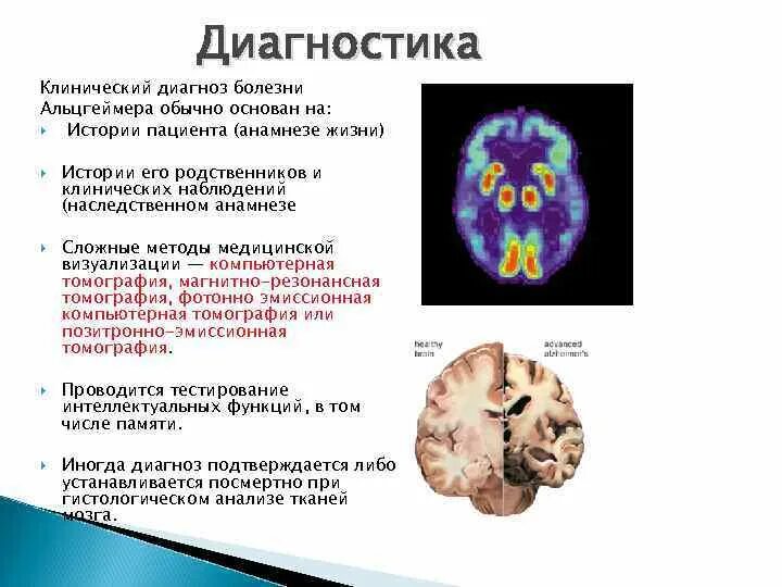 Ранняя стадия болезни альцгеймера. Диагностические критерии Альцгеймера. Диагностические критерии болезни Альцгеймер. План обследования при болезни Альцгеймера. Очаг поражения при болезни Альцгеймера.