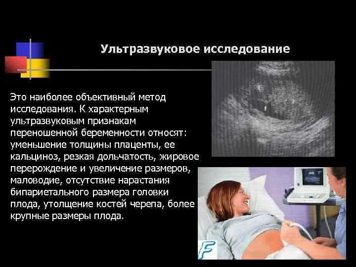Диагностика плода