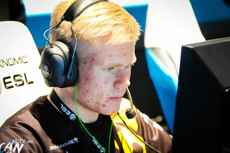 Magisk cs2. Magisk cs go. magisk киберспортсмен. смешные киберспортсмены. лысые киберспортсмены.