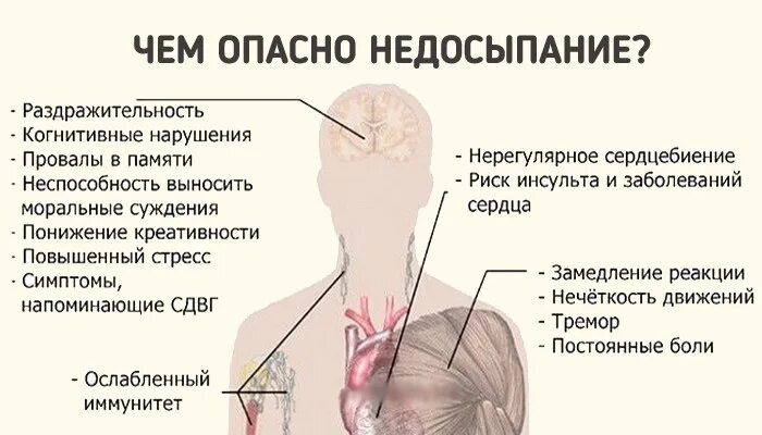 Недосыпание симптомы. Признаки недосыпа. Опасности хронического недосыпания. Хронический недосып симптомы. Болезнь провалы в памяти