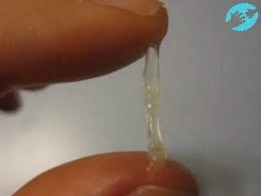 Вагинальные выделения. Девушки текут белой. Стекловидные выделения. Выделения цервикальной слизи. Девушки текут белой.