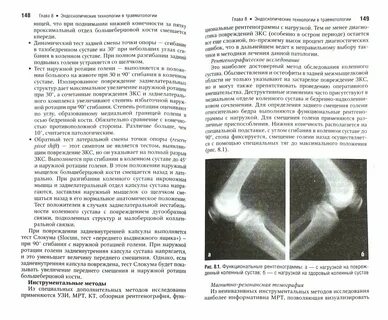 Повреждения суставов травматология