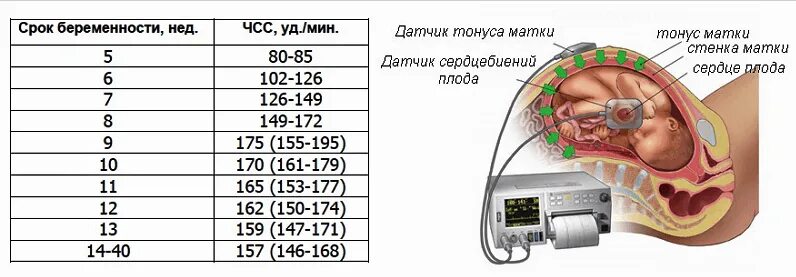 Тонус 33 недели. Сердцебиение плода по неделям. Норма сердцебиения плода. ЧСС плода по неделям. Тонус матки в норме.