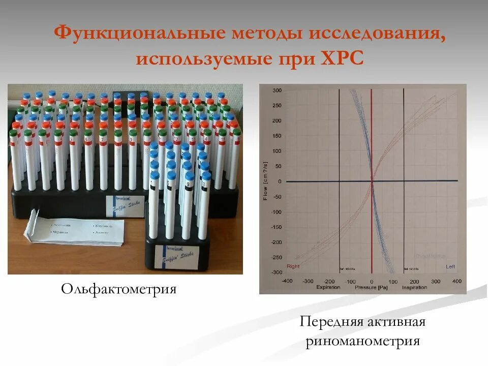 Какие методы функционального исследования. Функциональные методы исследования. функциональный метод исследования. функциональные методы исследования в стоматологии. передняя активная риноманометрия.