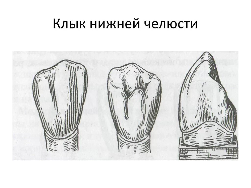 Форма резцов зубы. Моделировка клыка верхней челюсти. анатомическая форма клыка верхней челюсти. клык нижней челюсти. анатомия зубов нижней челюсти клык.
