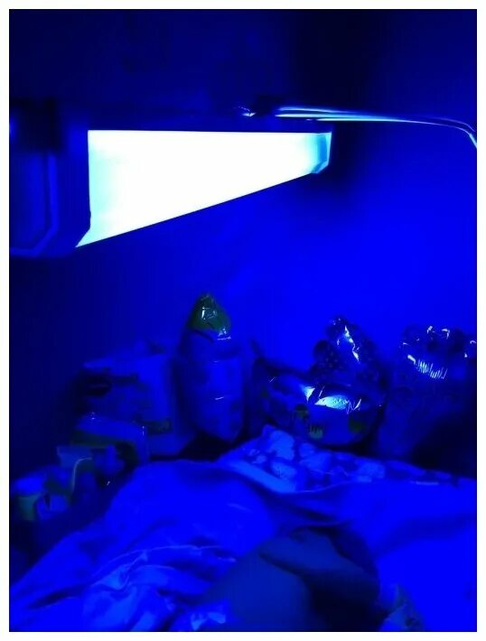 ультрафиолетовая лампа для желтухи. лампа от желтушки для новорожденного philips. синяя лампа для новорожденных. ультрафиолетовая лампа для новорожденных от желтушки. фотолампа желтуха.