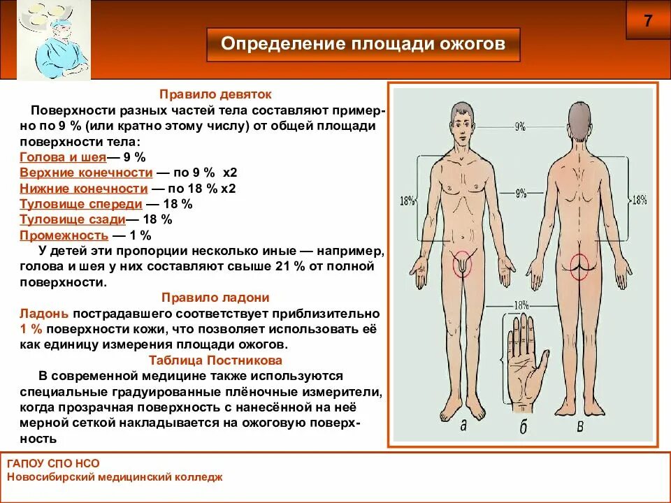 Опасные для жизни ожоги площадью. Площадь ожоговой поверхности. Определение площади ожогов тела. Способы определения площади ожога.