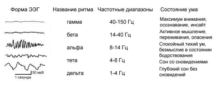 Альфа ритм ЭЭГ. Ритмы мозга Альфа бета тета Дельта ритмы. Альфа ритм бета ритм тета ритм Дельта ритм ЭЭГ. Правильная частотная характеристика ритмов ЭЭГ.