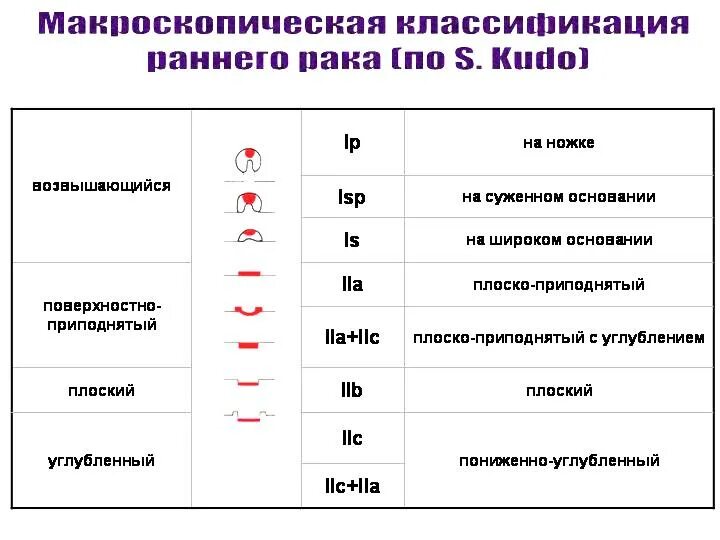 Тип 0 is. Классификация полипов желудка эндоскопическая. Парижская классификация полипов толстой кишки. Эндоскопическая классификация опухолей желудка. Классификвция полиаов Париж.