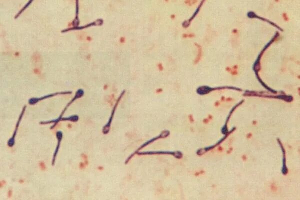 Копрология кала микроскопия норма. Corynebacterium diphtheriae колонии. Грамположительные кокки. Стрептококки микробиология. Копрограмма в норме микроскопия.
