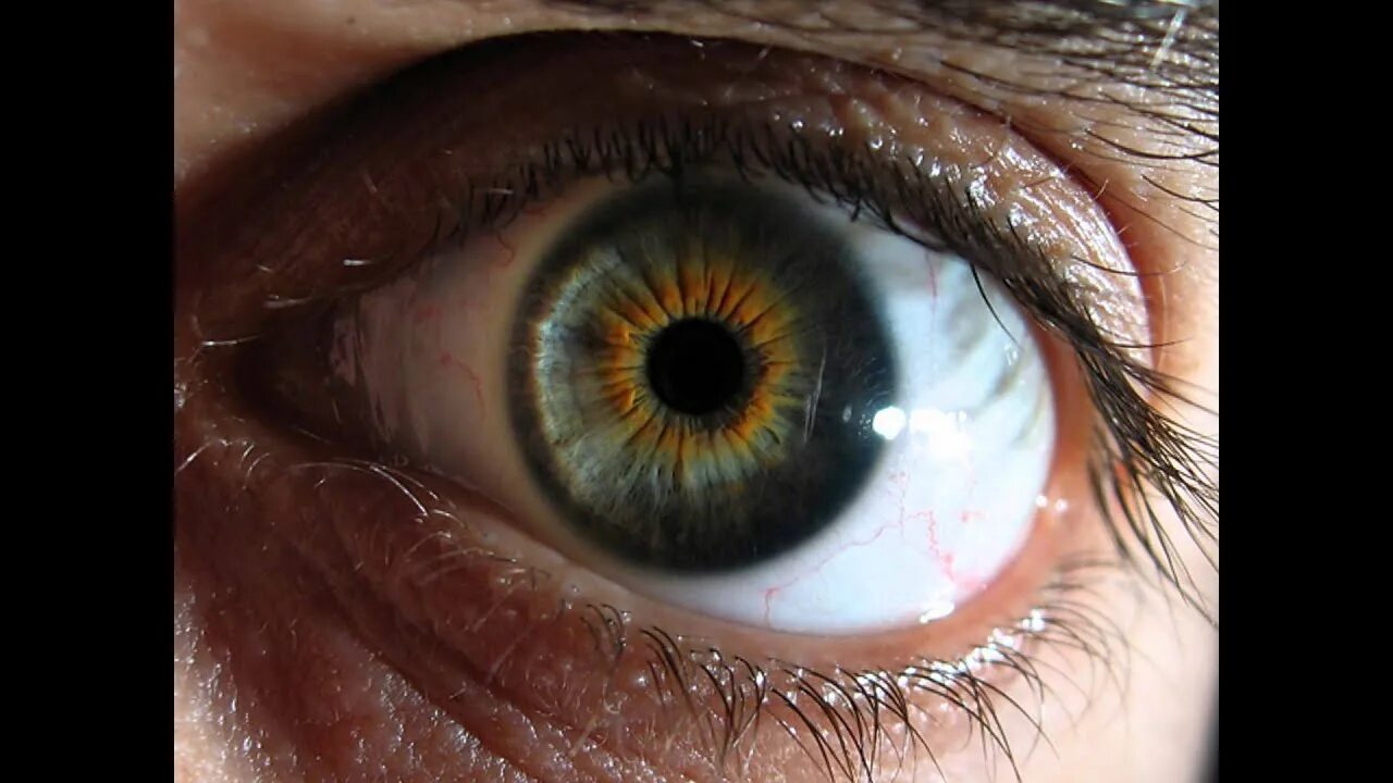 Сетчатка глаза и катаракта. Cataract Eye начальная стадия. Глаз человека. Место в сетчатке напротив зрачка
