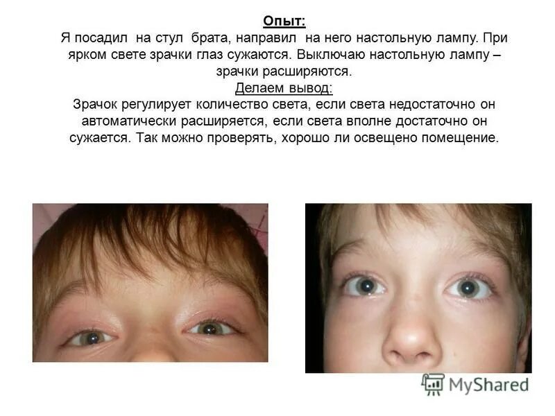 радиальные мышцы зрачка. радужная оболочка и зрачок строение. сужается при ярком свете. кто паботает приярком светк. сужается при ярком свете.