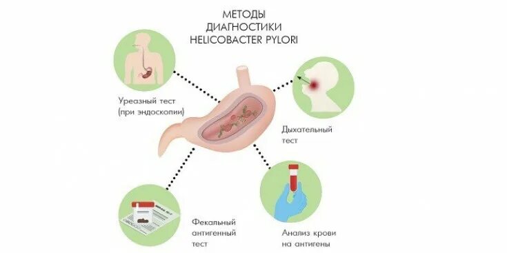 Анализ дыхательный уреазный тест. Дыхательный тест на хеликобактер пилори. Санбюллетень хеликобактер пилори. Хеликобактер пилори в желудке патогенез. Профилактика инфицирования хеликобактер пилори.