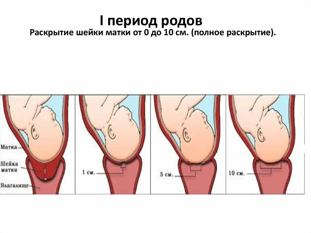 Шейка при родах сколько. Раскрытие шейки матки при родах периоды. Раскрытие шейки матки при родах 4 пальца. Роды раскрытие шейки матки 10см. Стадии раскрытия шейки матки.