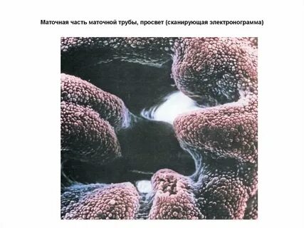 Слизистая маточных труб выстлана эпителием