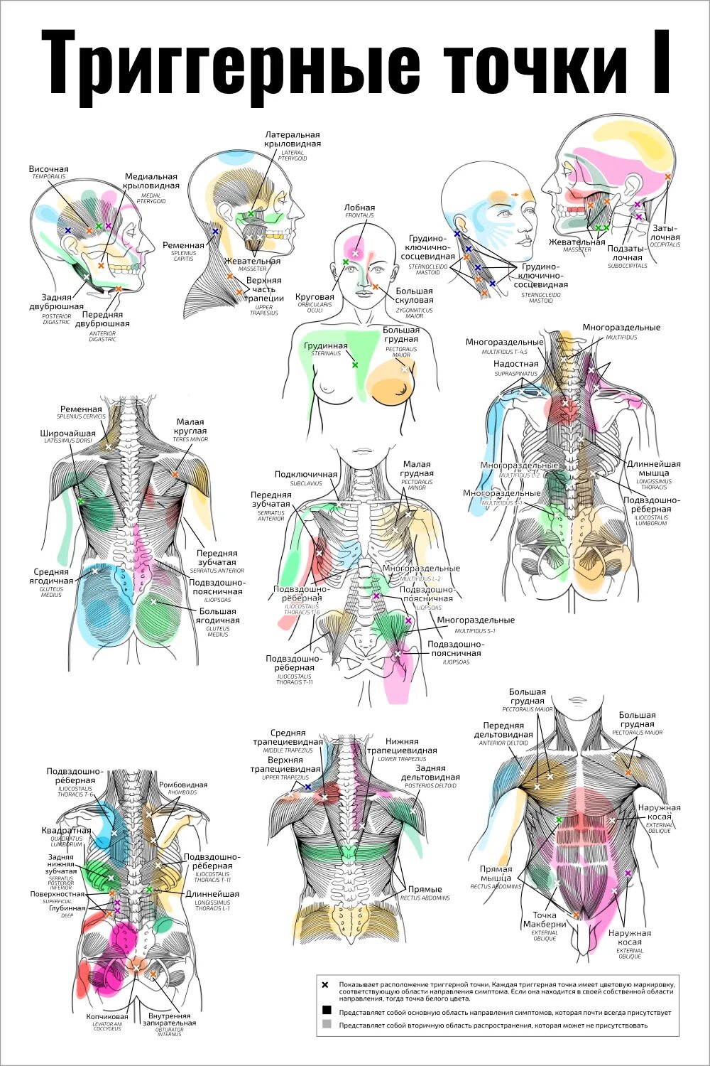 Триггерные точки i медицинский плакат. Триггерные точки атлас. Терапия триггерных точек. Карта триггерных точек. Триггерные точки это простыми словами