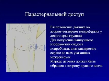 Шумы у левого края грудины
