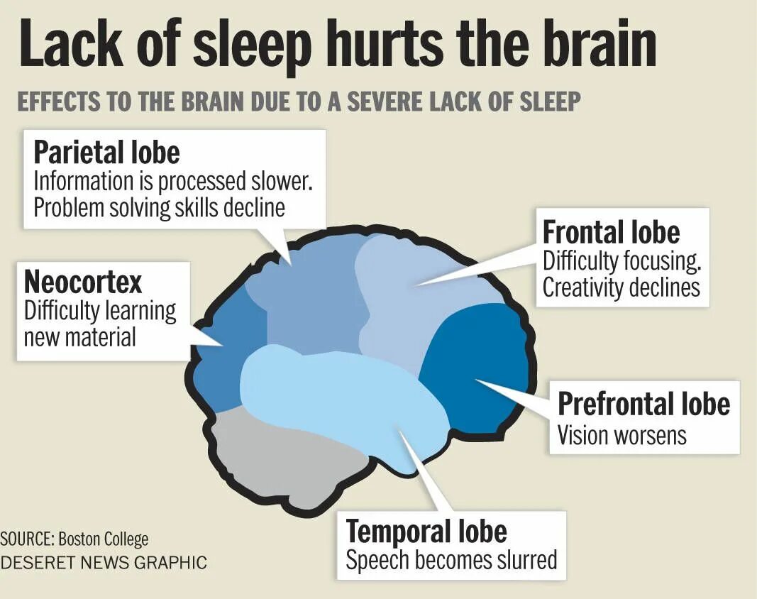 Brain Sleep. Sleep Effect. Brain Effect Sleep. Kinds of Sleep.