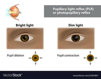 Dim eye