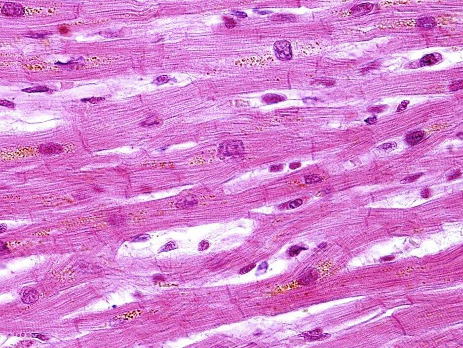Клетка сердечной поперечно полосатой мышечной ткани. Гладкая мышечная ткань микропрепарат. Клетки мышечной ткани гистология. Поперечно полосатая сердечная мышечная ткань препарат миокарда.