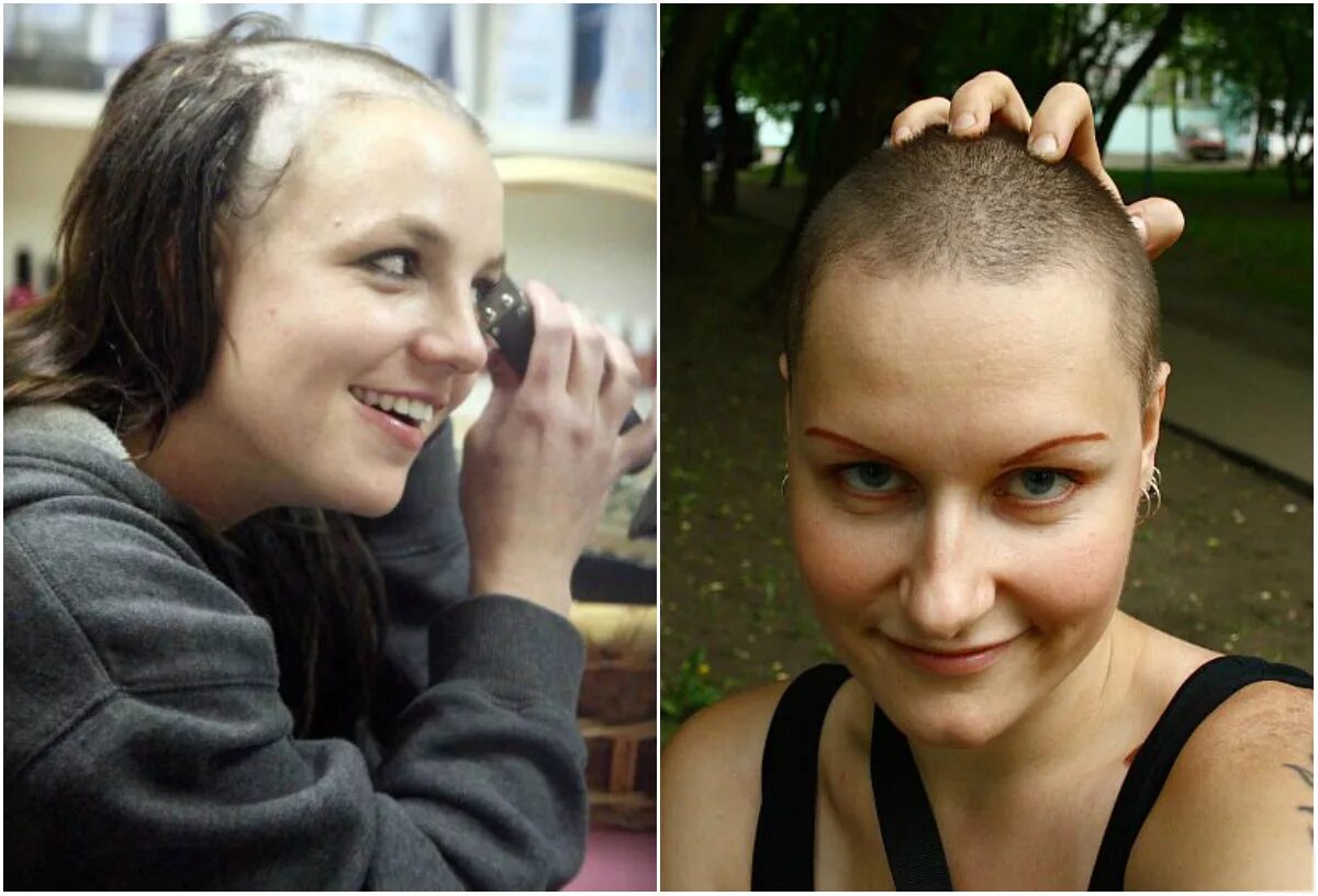 Рост волос после химиотерапии. Лысая стрижка до и после. Волосы после стрижки налысо. Прическа после химиотерапии. Лысые девушки до и после.
