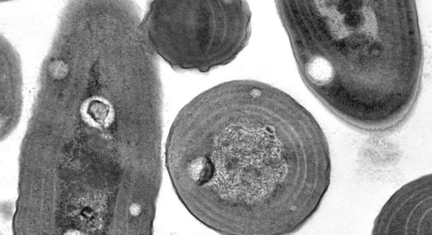 Первые клетки возникли. Окаменевшие цианобактерии. Первая клетка. Самая Старая бактерия. Окаменевшие бактерии.