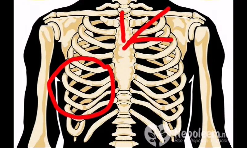 Сильно болят левые ребра